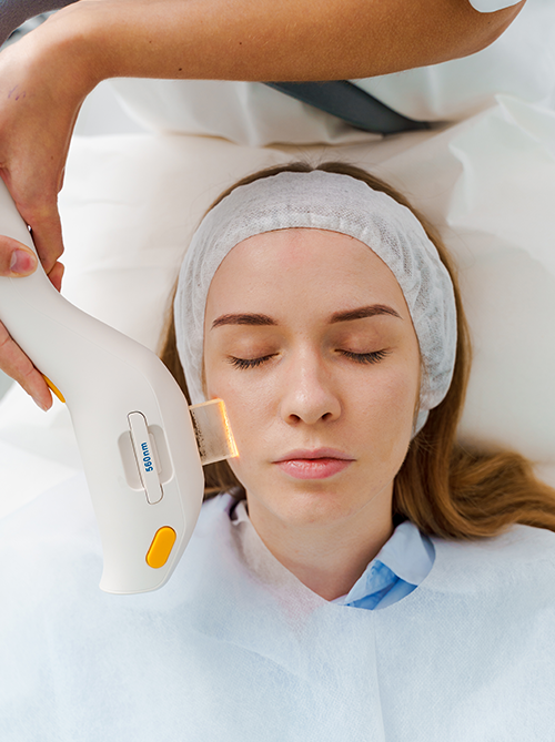 ipl photofacial