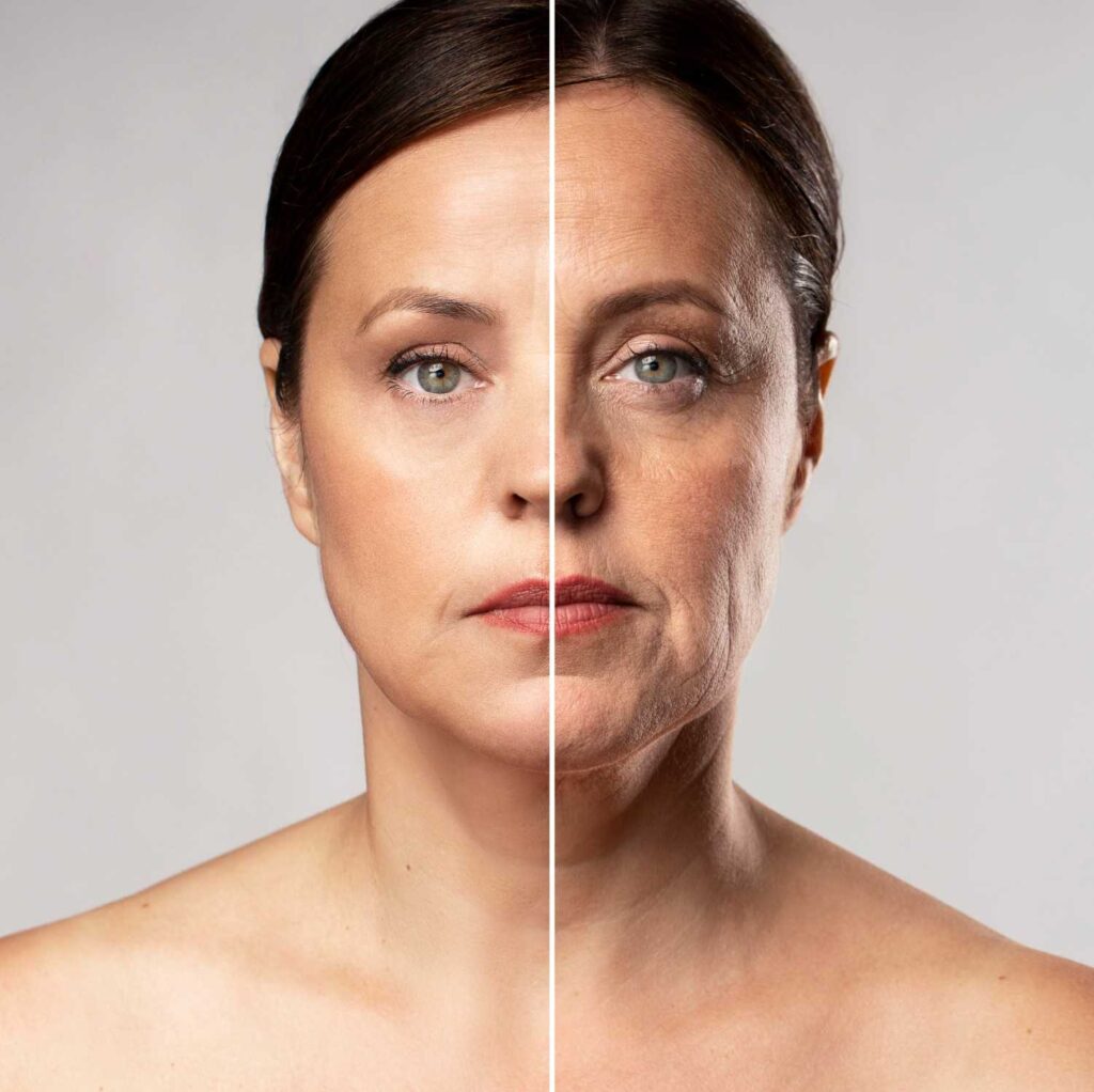 Before and after Morpheus8 treatment showing improved skin texture, reduced wrinkles, and facial rejuvenation